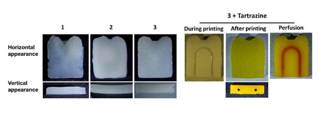 타트라진을 활용한 미세 통로 구조 구현. (왼쪽) 타트라진을 첨가하지 않은 경우 내부 통로가 일부 막히는 현상이 나타났다. (오른쪽) 타트라진 0.1%를 첨가한 경우 지름 0.7mm 규모의 통로가 설계 형태대로 유지됐다. 연구팀은 이를 통해 혈관 구조를 모사할 수 있는 미세 통로 구현 가능성을 제시했다. /이미지=한림대학교춘천성심병원