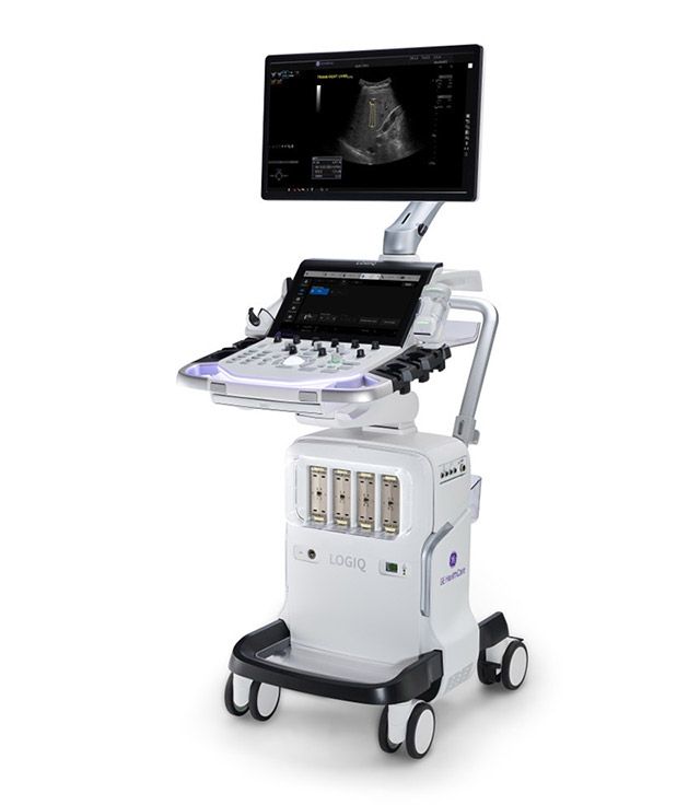 지방간 정량 측정 기능 ‘UGFF(Ultrasound-Guided Fat Fraction)’이 적용된 GE헬스케어 초음파 진단기기 ‘LOGIQ Totus R5’. /사진=GE헬스케어