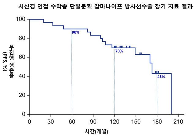 시신경 인접 수막종 환자에 대한 감마나이프 방사선수술 장기 추적 결과, 무진행 생존율은 5년 90%, 10년 70%, 15년 43%로 감소하는 양상을 보였다. /이미지=서울대병원
