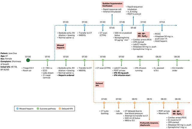 의료 AI 개입 시점에 따라 환자 상태가 서로 다른 경로로 변화하는 시뮬레이션 결과. 치료 지연 시 상태 악화로 이어질 수 있음을 보여준다. /자료=서울대병원