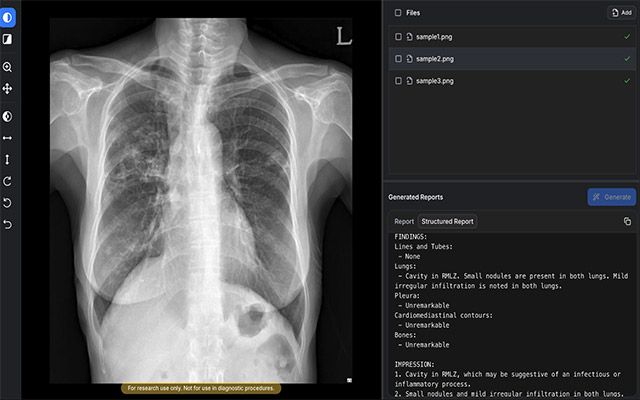 AIRead-CXR이 흉부X선 영상을 분석해 예비소견서를 생성한 화면 예시 /이미지=숨빗AI