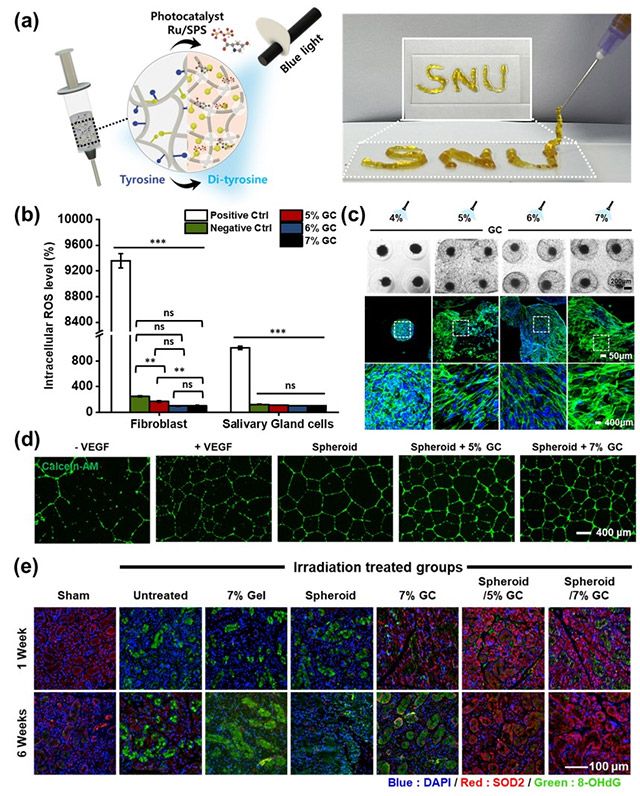 줄기세포 스페로이드와 항산화 전달체를 결합한 융합 치료 시스템 개요와 전임상 결과. 전달체 투여 후 활성산소 감소, 혈관 생성 증가, 침샘 조직 재생 등 단계적 효과가 확인됐다. /이미지=서울대병원