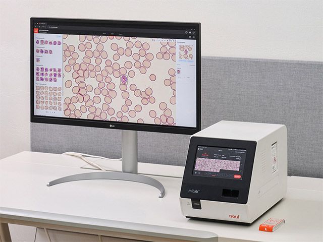 노을 AI 기반 말라리아 솔루션(miLab MAL) /사진=노을