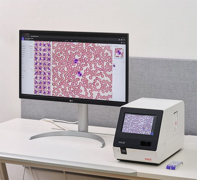 AI 기반 형태학 분석 기능을 적용한 전혈구검사(CBC) 통합 혈액 분석 솔루션 ‘miLab BCM’. /사진=노을