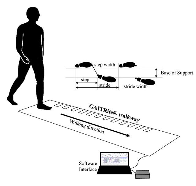 전자식 보행 분석 장비 ‘GAITRite’를 이용해 파킨슨병 환자의 보행 속도·보폭·보행 패턴 등을 측정하는 개념도. /이미지=삼성서울병원