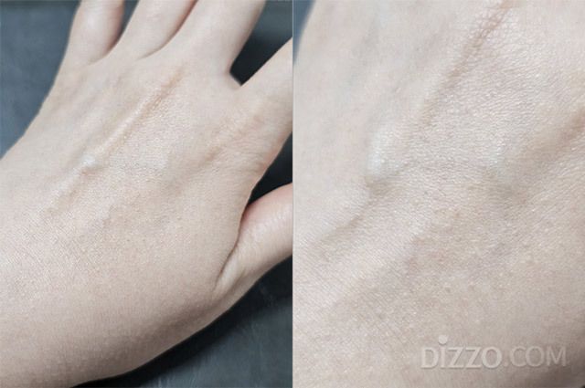 노동절 연휴에 발생한 두드러기. 처음에는 가렵거나 따갑지 않았지만, 뜨거운 물 샤워 이후 증상이 나타났다. /김정아 기자