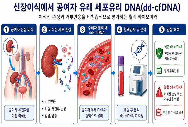 신장이식 후 이식신 손상으로 혈액 내에 증가하는 공여자 유래 세포유리 DNA(dd-cfDNA)를 측정해 거부반응 위험을 평가하는 원리 모식도. /서울대병원 제공