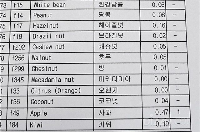 알레르기 혈액검사 결과. 의심했던 갑각류와 조개류는 음성이었고, 10년 넘게 매일 먹어온 사과에서 클래스 1 반응이 확인됐다.
