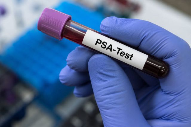 PSA검사. AI 생성이미지