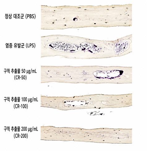 실험쥐 머리뼈 조직 내 골 염증 유발군(LPS)에서 급증했던 파골세포(보라색)와 골미란 현상이 구척(CR) 추출물 투여 농도가 높아질수록 현저히 감소했으며, 최고 농도(CR-200)에서는 정상 대조군(PBS)과 유사한 수준으로 회복됐다.