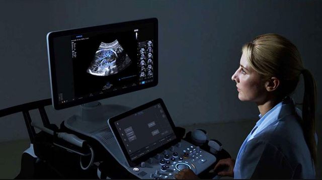 산부인과용 초음파 진단 기기 HERA W10. [사진=삼성메디슨]