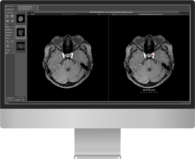 [사진=딥노이드]