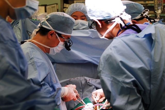 조양현 교수(왼쪽)가 심장이식 수술을 집도하고 있다. [사진=삼성서울병원]