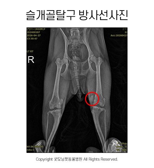 슬개골이 내측으로 빠진 모습(빨간 동그라미)