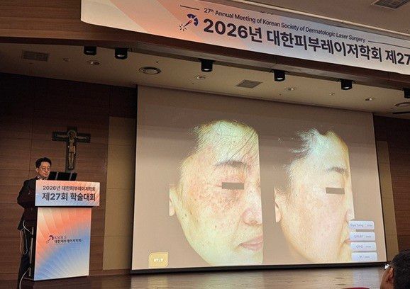 김현조 원장은 어브놈을 동반한 환자의 성공적인 치료사례를 소개하며 초기 정확한 진단과 맞춤 치료전략이 환자의 만족도와 삶의 질을 높이는 핵심이라고 강조했다.&nbsp;