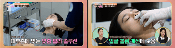 중헌제약의 로리앙 필러가 11일 방송된&nbsp;채널A ‘뷰티클리닉 터치미’ 우혜림 편에 소개됐다. 이날 방송에서는 피부층에 맞는 필러시술과 제품의 물성 및 순도의 중요성이 조명됐다(사진=채널A ‘뷰티클리닉 터치미’&nbsp;제공).