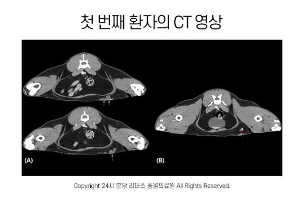 (A) 좌측 뒤쪽 유선 주변으로 결절들(노란 화살표) 확인되어 유선종양 의심됨. (B) 같은 쪽 서혜부 림프절의 경미한 비대 확인되어 FNA(세침흡인검사) 진행하였음. FNA상 전이 의심됨.