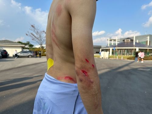 양선호(은평구청)의 상처