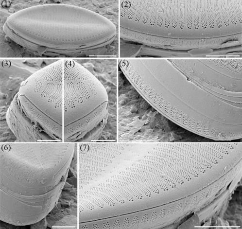 기페니아 코리아나의 다양한 형태