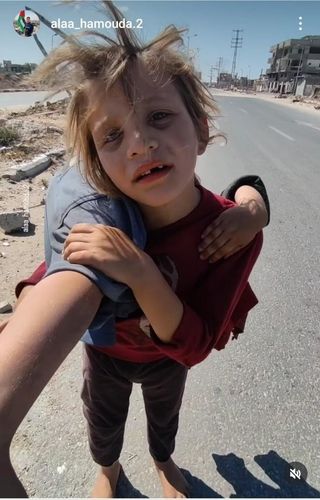 맨발로 동생 업고 걷던 가자지구 소녀