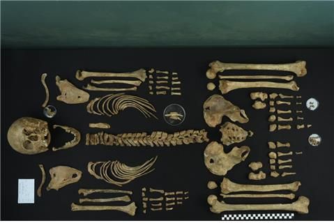 6·25 전사자 송영환 일병 유해