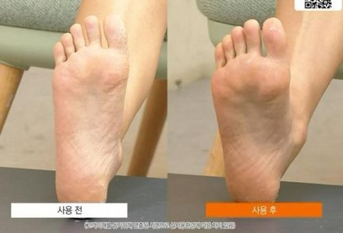 각질제거제 판매 방송 장면