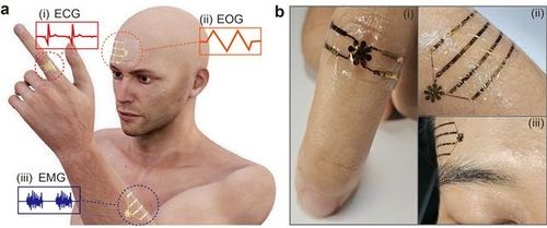 연구 개략도(왼쪽)와 실제 인체에 부착된 연구팀 개발 장치