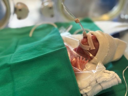 국내서 가장 작은 '260ｇ' 아기 예랑이