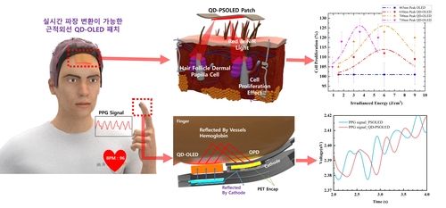 탈모 치료용 QD-OLED 패치