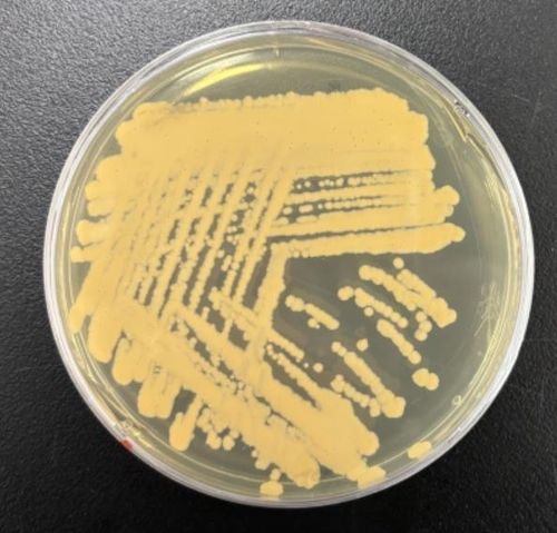 로도코커스 큉솅지 고체배지 배양 사진