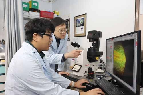 알츠하이병 원인 단백질 제거 원리 밝힌 연구팀