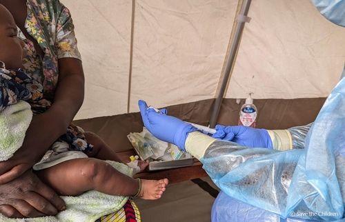 엠폭스 감염된 생후 5개월 아기