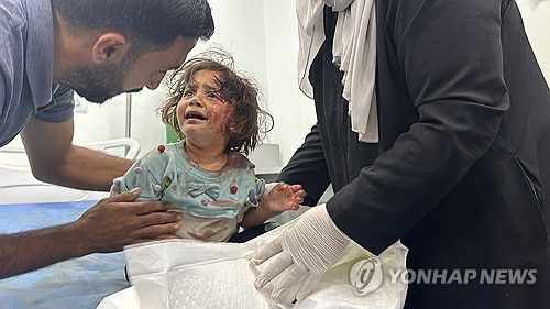 이스라엘 공습에 다친 팔레스타인 아기 