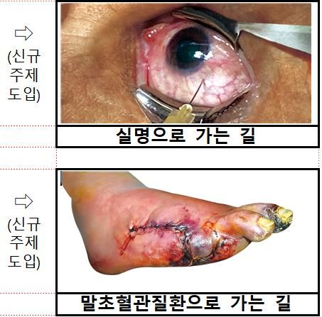 새롭게 도입되는 담뱃갑 경고그림과 문구