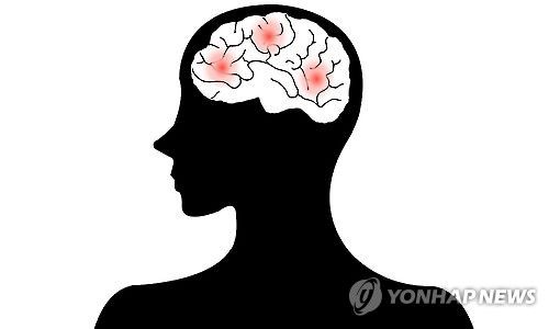 뇌졸중(일러스트)