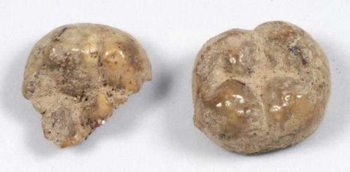 무덤 주인(피장자)의 치아