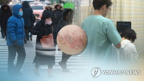 면역력 떨어지는 겨울…빈 틈 노리는 대상포진 (CG)