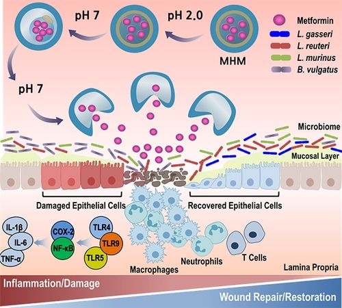 메트포르민 캡슐의 대장 염증 부위 적용 모식도