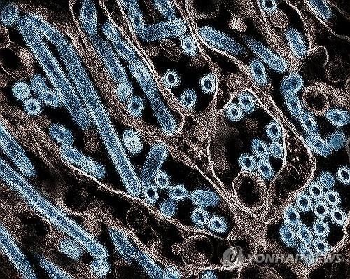 현미경에 투과된 조류 인플루엔자 H5N1 바이러스 이미지