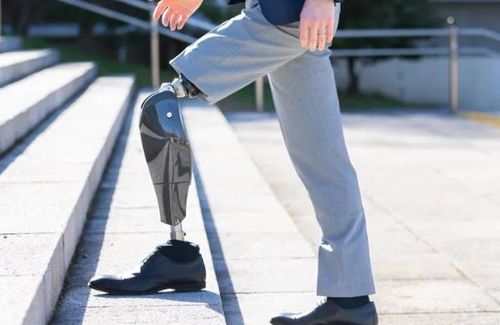 바이오닉엠의 로봇 의족 '바이오 레그'