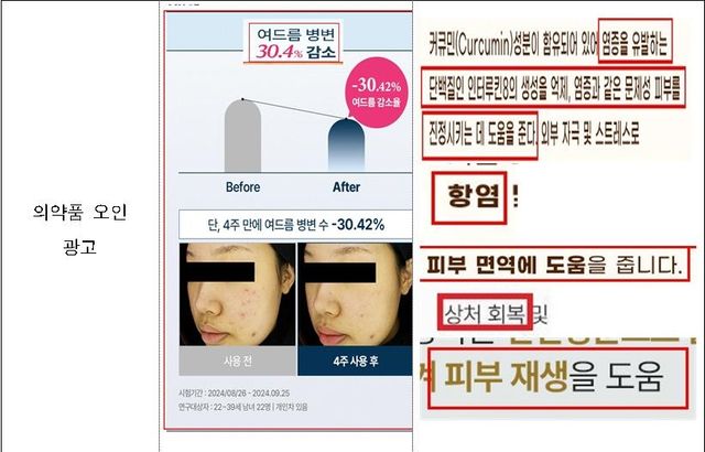 의약품 오인 화장품 광고