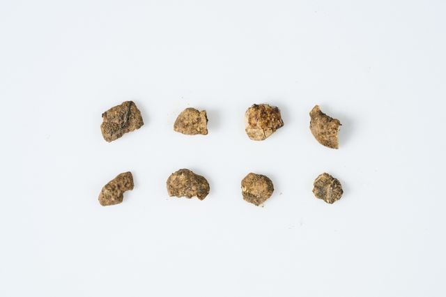 무덤 주인의 치아 