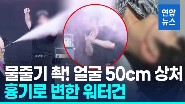 [영상] 흉기로 변한 워터건…축제 공연서 물줄기 '확!' 얼굴·손 찢어져 - 2