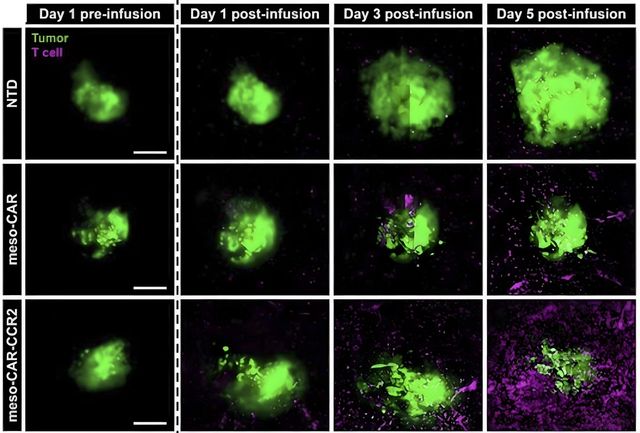 3차원 칩에서의 CAR-T 세포 치료 효과 관찰 
