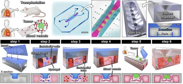 고형암 조직을 이식해 개발한 3차원 미세 칩 모식도 