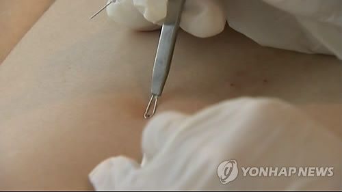 피부 관리. 위 사진은 기사와 직접적인 관련이 없습니다.