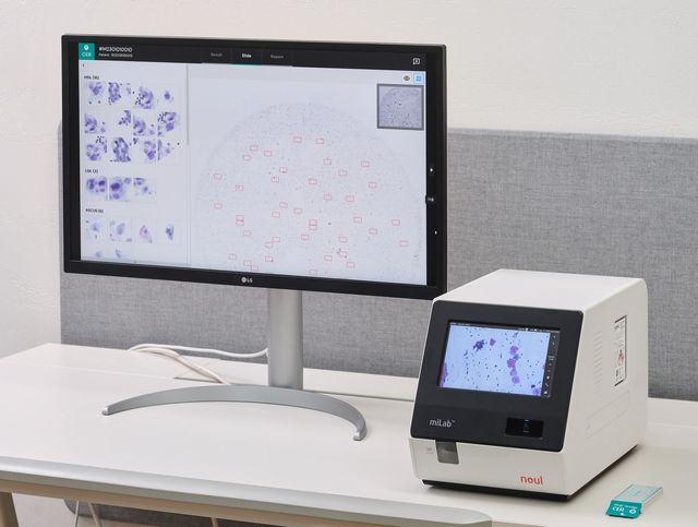 자궁경부암 진단 설루션