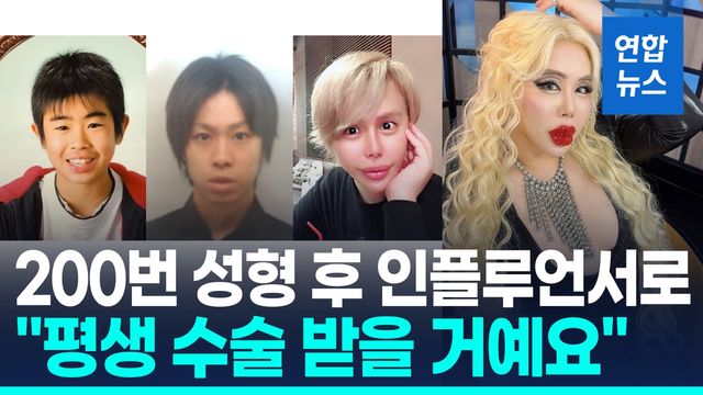 [영상] 왕따에서 셀럽으로 변신한 日 남성…"성형수술에 10억원" - 2