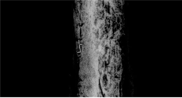 디지털 X-선 필름으로 확인된 글자 '上'