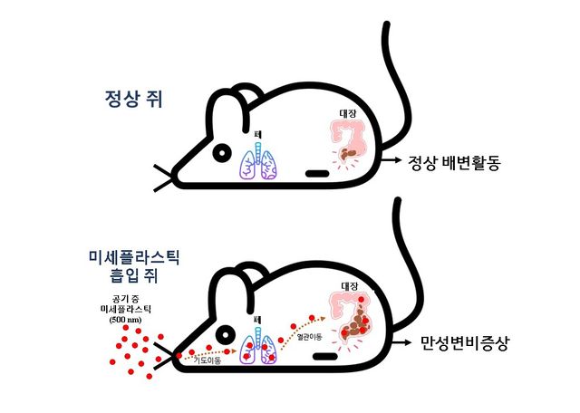 공기 흡입 미세플라스틱 연구 이미지